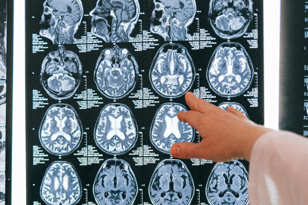 Understanding Medical Negligence Claims_ The First Steps