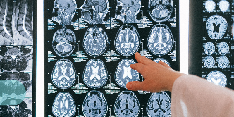 Understanding Medical Negligence Claims_ The First Steps